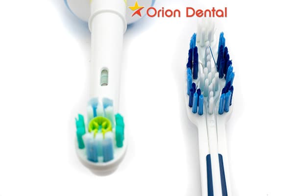 Stock image of manual and electric toothbrushes side by side