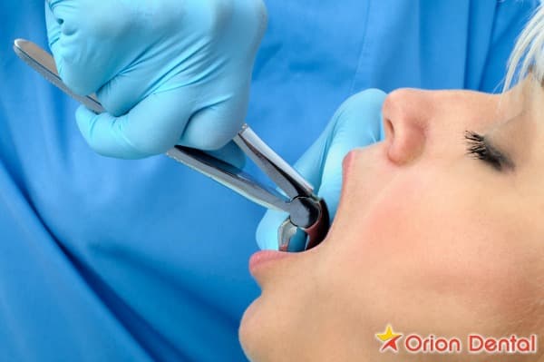 Stock image of an adult smiling