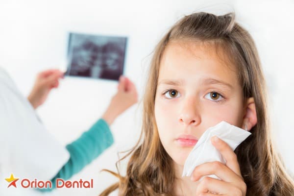 Stock image of a girl holding a tissue to her cheek while a dental X-ray is shown in the background