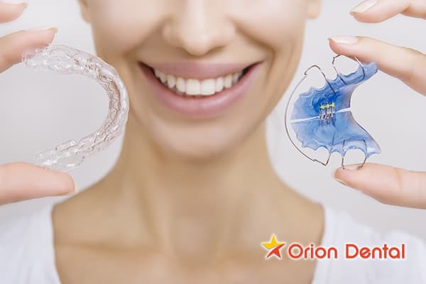Stock image of orthodontic braces and a retainer