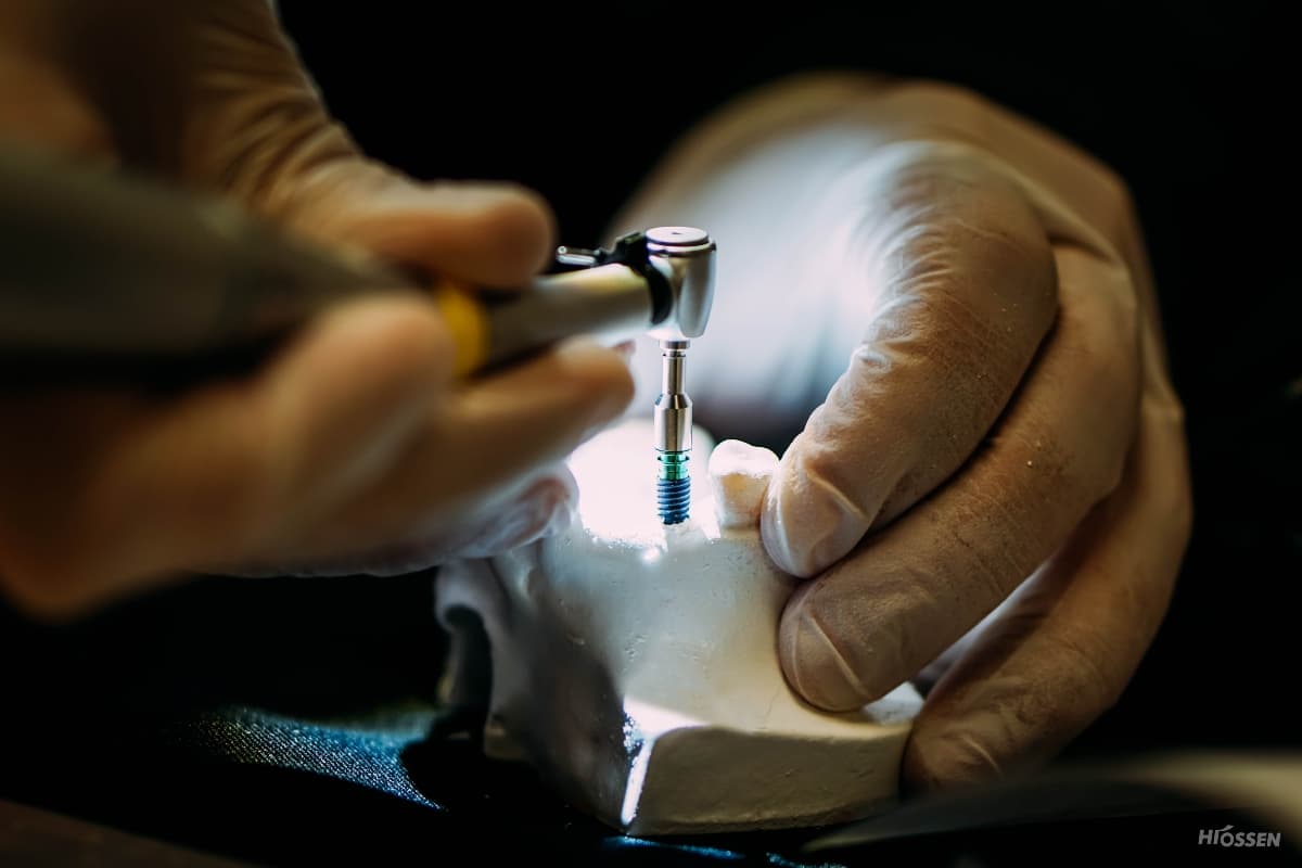 Stock image of a dental professional's gloved hands placing an implant into a model of teeth