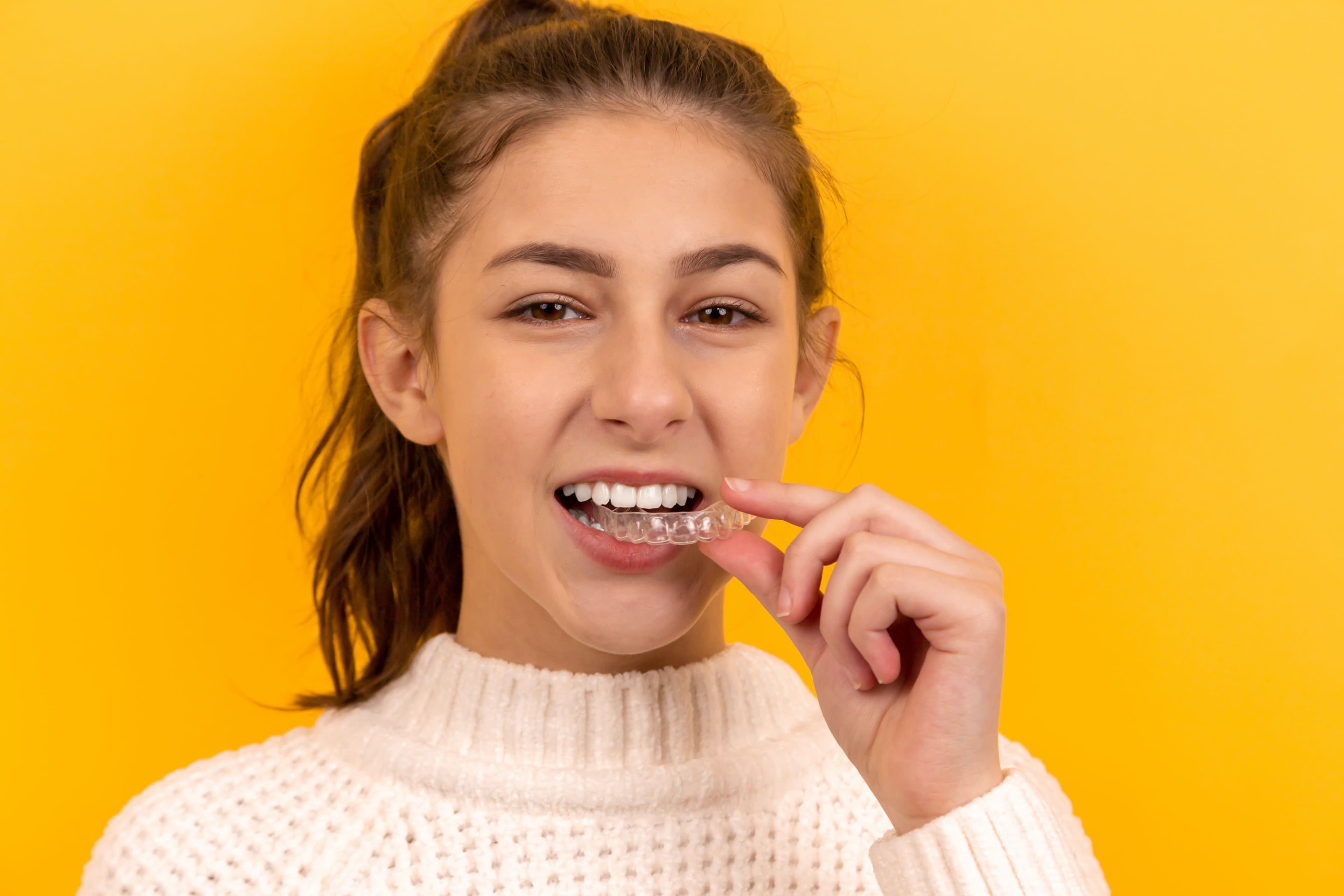 Stock image illustrating clear aligner treatment