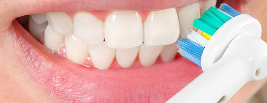 Orion Dental - features to consider when buying an electric toothbrush
