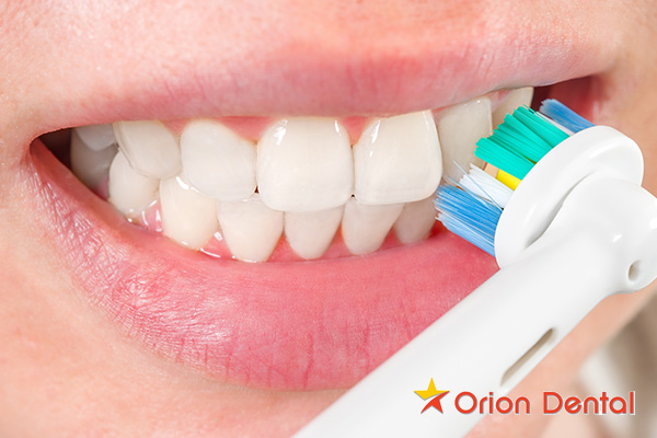 https://oriondental.ca/wp-content/uploads/2015/10/Orion-Dental-features-to-consider-when-buying-an-electric-toothbrush.jpg