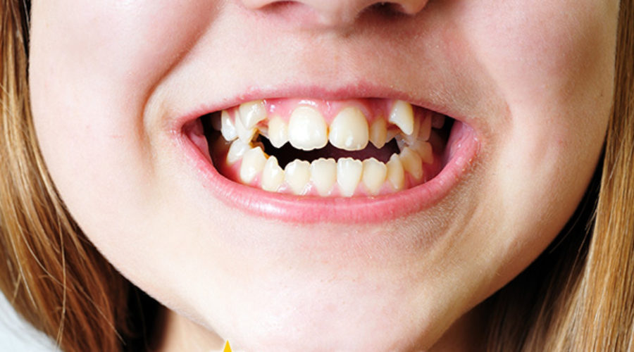 Orion Dental - Common Types of Bite Problems Explained