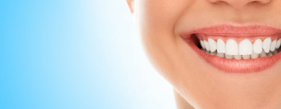 Teeth whitening options at Orion Dental