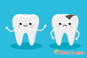 Orion Dental :: Cartoon image of tooth decay