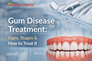 Gum Disease Treatment