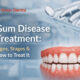 Gum Disease Treatment: Signs, Stages & How to Treat It