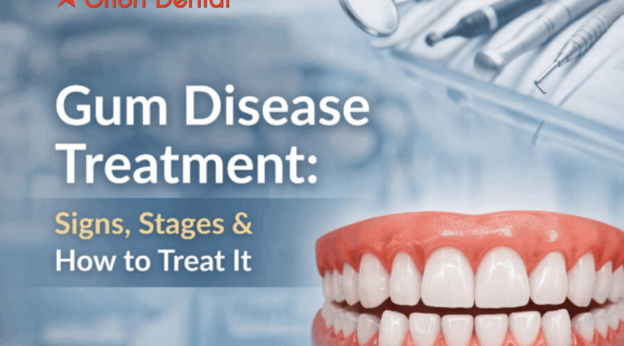 Gum Disease Treatment