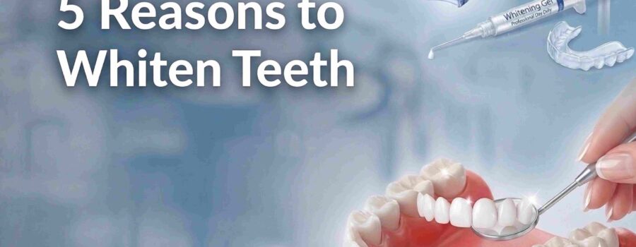 5 Reasons to Whiten Teeth Professionally with a Dentist
