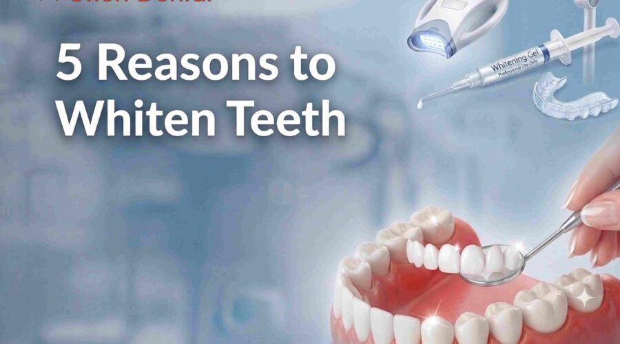 5 Reasons to Whiten Teeth Professionally with a Dentist